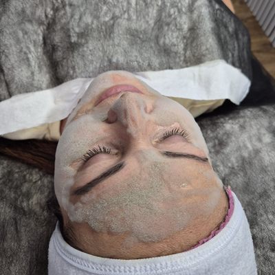 Carboxy Therapy